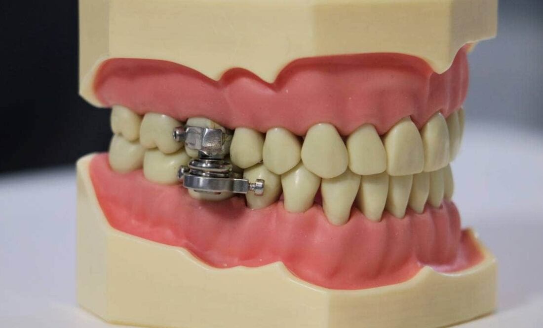 Fue diseñado por la Universidad de Otago.