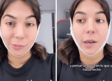 Joven impacta en la red al enseñar la parálisis facial que sufrió tras cirugía estética