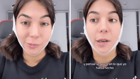 Joven impacta en la red al enseñar la parálisis facial que sufrió tras cirugía estética
