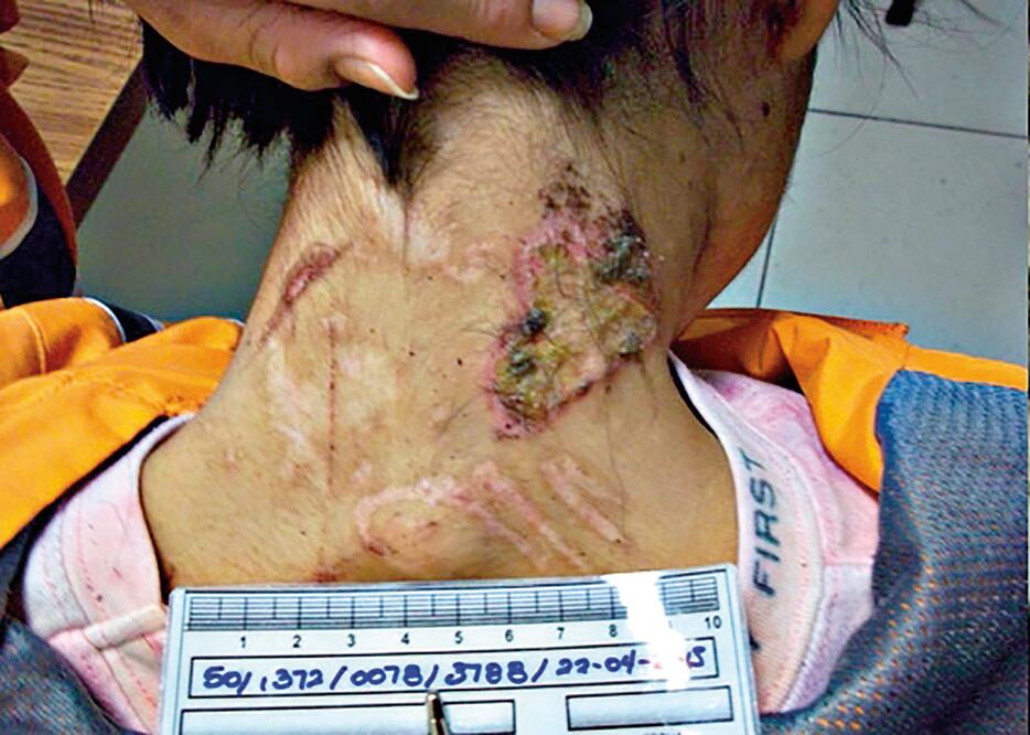 Autoridades rescataron a una joven de 22 años que por más de 24 meses estuvo encadenada del cuello a un mueble ubicado junto a la plancha de una tintorería; era golpeada hasta sangrar y, casi sin comer, tenía que trabajar más de 12 horas