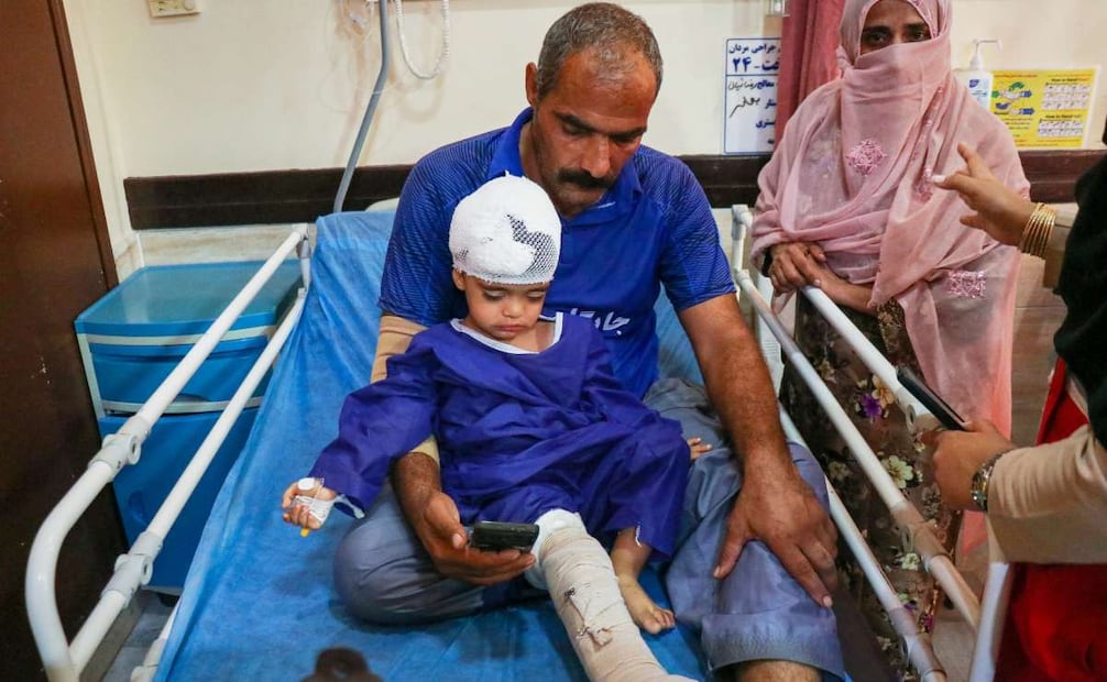 Un niño se recupera en el hospital tras ser herido por el presunto ataque de EU a una boda en Irán. (03/29/26) Foto: AP