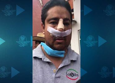 Víctima de presunto abuso policial en San Juanico dice ser elemento de la SSPCDMX