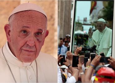 Papa Francisco se golpea el rostro en papamóvil en Colombia