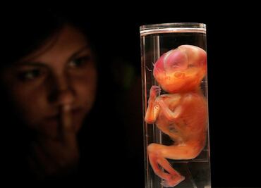 Exploran cómo se pliega el cerebro del feto a medida que se desarrolla