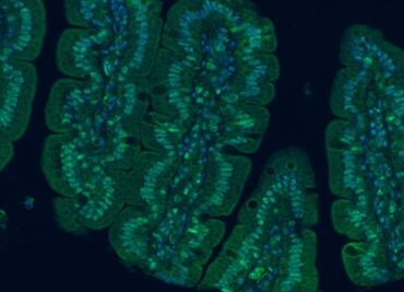 Bacterias intestinales tu mejor aliado para combatir diabetes y estrés