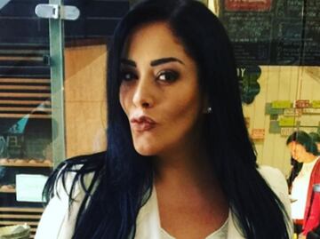 Marichelo Puente, en grave riesgo por tratamiento estético