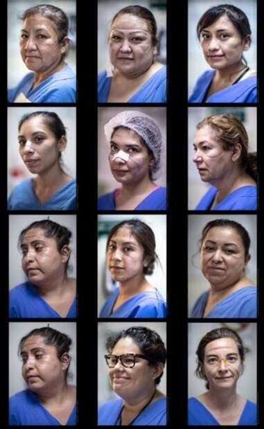 Photos show the bruised faces of Mexican female healthcare workers on the frontlines of coronavirus