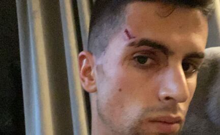 Joao Cancelo, jugador del Manchester City, sufre robo en su casa; los ladrones lo lesionaron