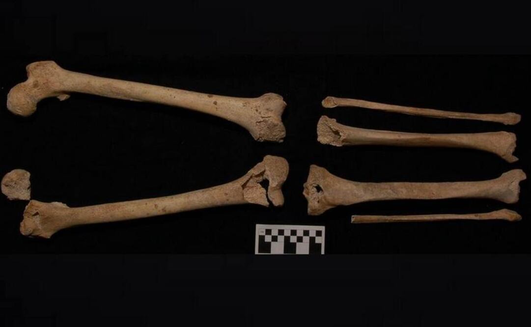 Los huesos coinciden con la cojera de Filipo, quien recibió un lanzazo en una pierna durante una batalla tres años antes de su muerte. (FOTO: Fundación Atapuerca)