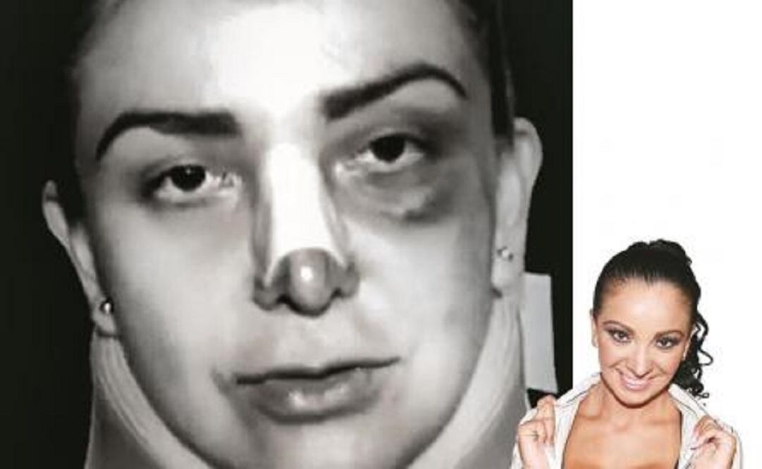 Marisa Moreno Bernat, granddaugther of Mario Moreno “Cantinflas”, arrived on September 19 at the hospital unconscious. (Photo: Special)