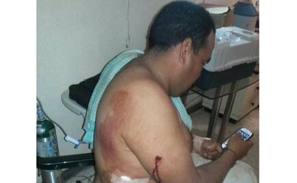 Se enfrentan en Tepalcatepec tras intento de pobladores por liberar a detenido