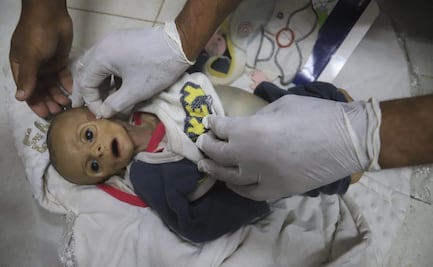 Bebé muere de hambre en Gaza; pesaba menos que al nacer