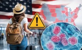 México alerta a quienes viajen a EU por brote de ciclosporiasis en 34 estados