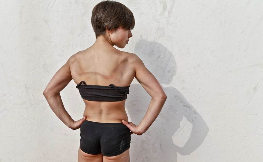 Inspirado por la escultura "Pequeña bailarina" de Edgar Degas, el fotógrafo David Flores Rubio muestra la belleza total de los bailarines de danza contemporánea. Con el "Proyecto Degas", el fotógrafo muestra a los bailarines sin edición ni retoque. Se centra en su musculatura y en sus heridas. (En la imagen, Mariana Barbosa Barquin).Cortesía