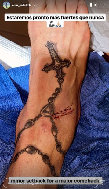 Alan Pulido muestra la brutal cortada que le dejó el pisotón de un rival