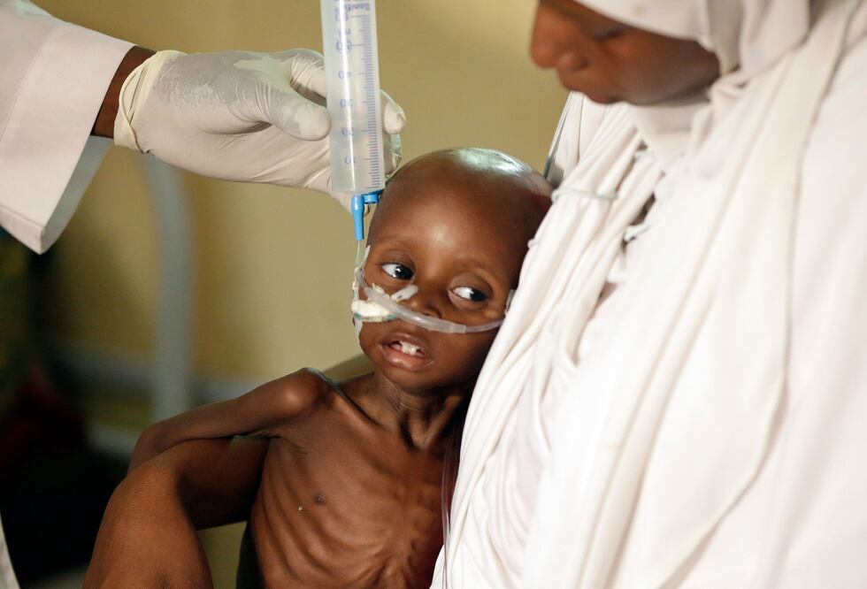 Un médico alimenta a un niño malnutrido en un centro de Médicos Sin fronteras en Maiduguri, Nigeria (Foto: AP)