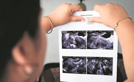 Identifica Segob a mujeres presas por interrupción del embarazo; quedarían en libertad