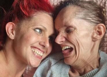 La esperanza de una cura para las 4 hermanas que viven atrapadas en sus cuerpos