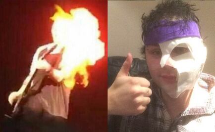Guitarrista de 5 Seconds of Summer se quema la cara en concierto