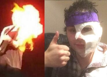 Guitarrista de 5 Seconds of Summer se quema la cara en concierto