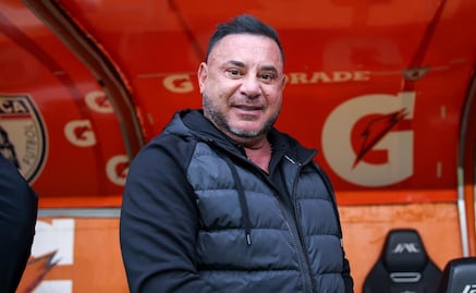 Turco Mohamed acepta el favoritismo de Toluca sobre Tigres, pero no se confía