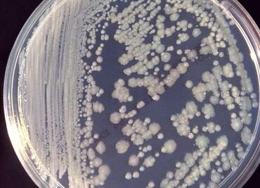 ¿Bacterias en el espacio? Sí, también se adaptan para sobrevivir