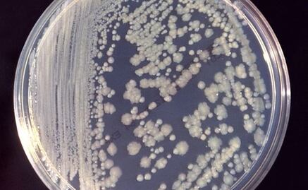 ¿Bacterias en el espacio? Sí, también se adaptan para sobrevivir