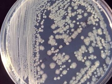 ¿Bacterias en el espacio? Sí, también se adaptan para sobrevivir