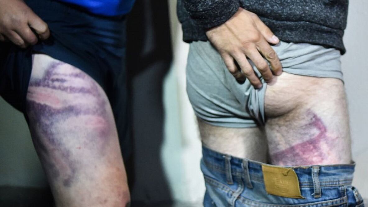 Varios testimonios denunciaron la brutalidad empleada por la policía en Bielorrusia. Foto: AFP