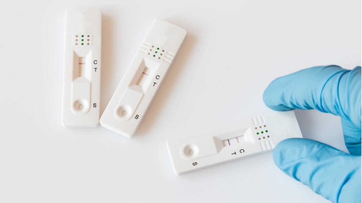 Los especialistas advierten que un resultado negativo en los primero días de síntomas deben ser tomados con cautela. Foto: Getty Images