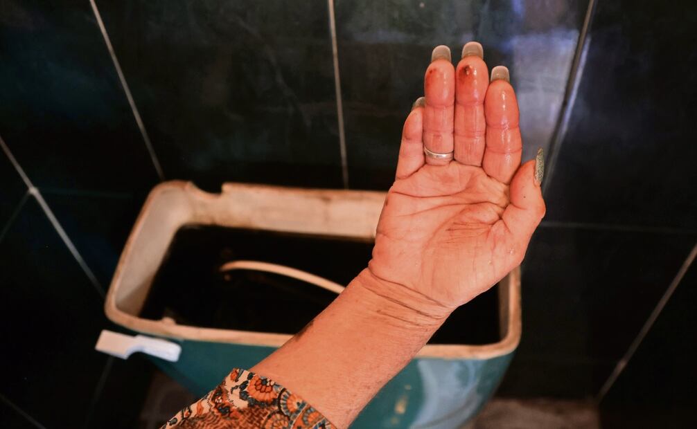 Luego de meter su mano al tanque del inodoro, muestra cómo en las paredes se acumula la suciedad. Foto: Carlos Mejía / EL UNIVERSAL