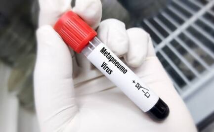Disminuyen casos de metapneumovirus al norte de China; descartan que se desate pandemia de esta enfermedad