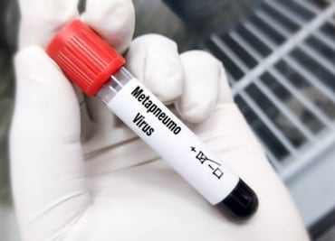 Secretaría de Salud confirma primer caso de Metapneumovirus en San Luis Potosí; aseguran que no hay motivo de alarma