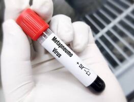Metapneumovirus en China; ¿qué tan preocupante es? Esto es lo que hay que saber