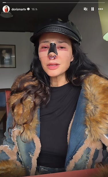 La modelo y actriz Dorismar comparte momento tras someterse a una cirugía luego de sufrir una mala praxis.