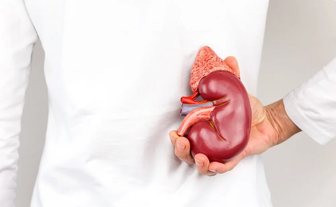 Hoy, 19 de junio, se celebra el Día Mundial del Cáncer de Riñón 2025. Foto: Instituto de Urología