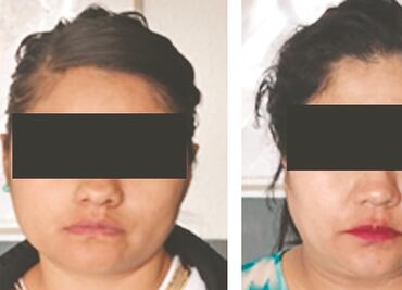 Vinculan a proceso a dos presuntas goteras que operaban en Zona Rosa y Roma-Condesa