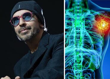 Linfoma de Hodgkin; ¿cuáles son los síntomas de la enfermedad que padecía Memo del Bosque?