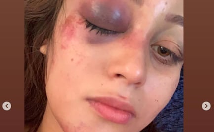 "Si no lograba escaparme, quizás ya no estuviera viva", joven denuncia en redes agresiones de su expareja