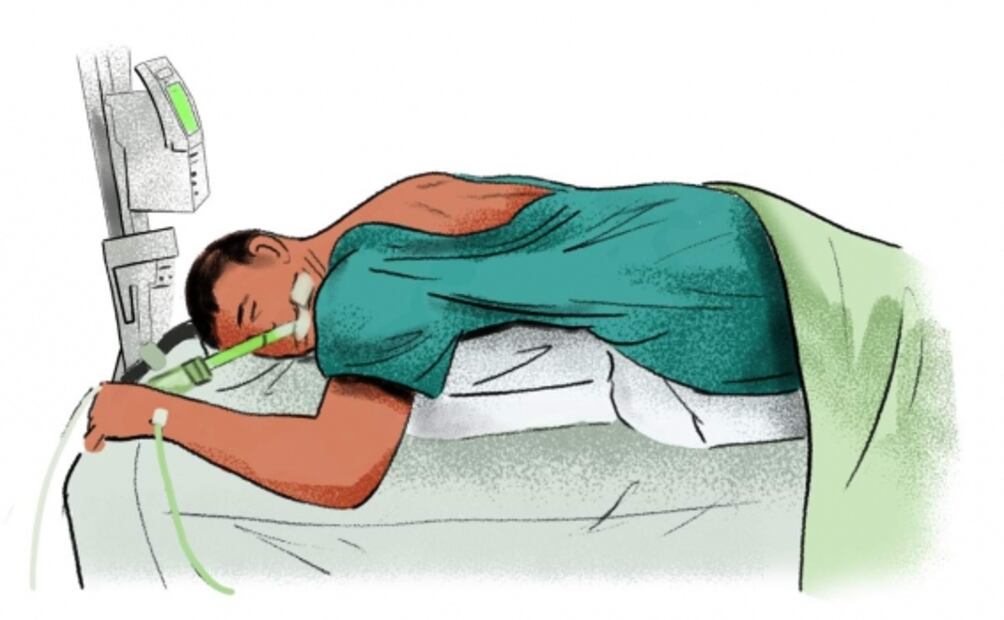 Jorge venció al Covid pero su cuerpo aún no se recupera