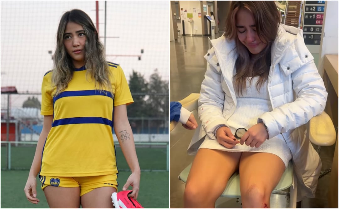 La influencer reveló detalles de sus lesiones, consecuencia del ataque que sufrió en Marsella a inicios de diciembre. Foto: Instagram @mercedes_roa