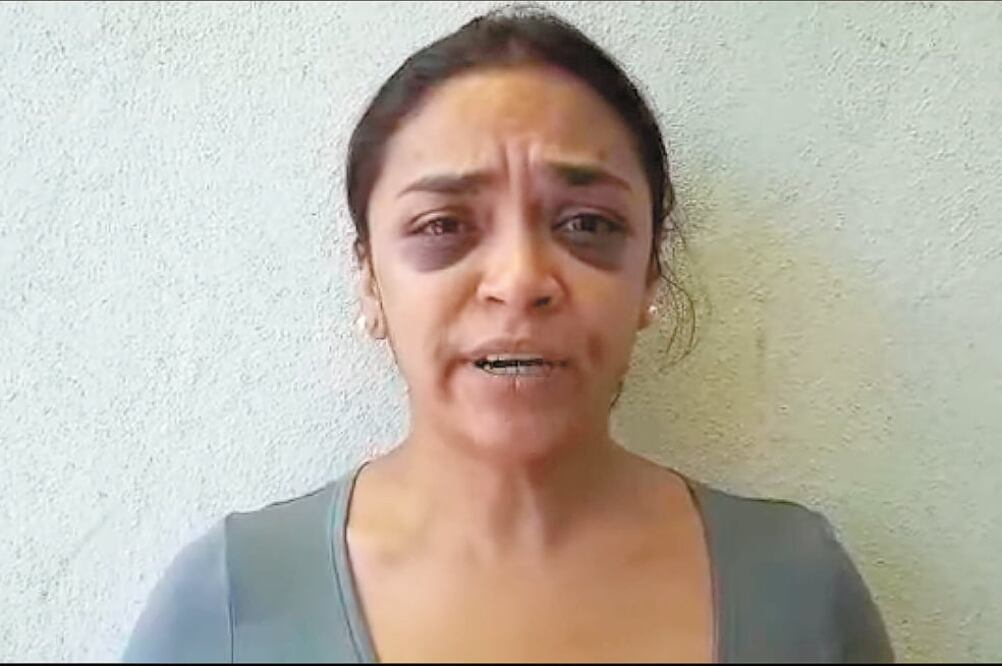 La reportera Mitzi Torres Quintero denunció que el martes 20 de agosto fue detenida y golpeada por agentes municipales de Morelia. Foto/ESPECIAL