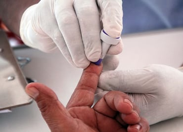 Día Mundial de la Lucha contra el Sida: México registra 15 mil 789 casos de VIH en 2024; entidades presentan aumento en diagnóstico