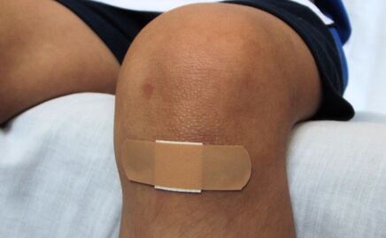 El exquisito alimento que cura las heridas de la piel de inmediato