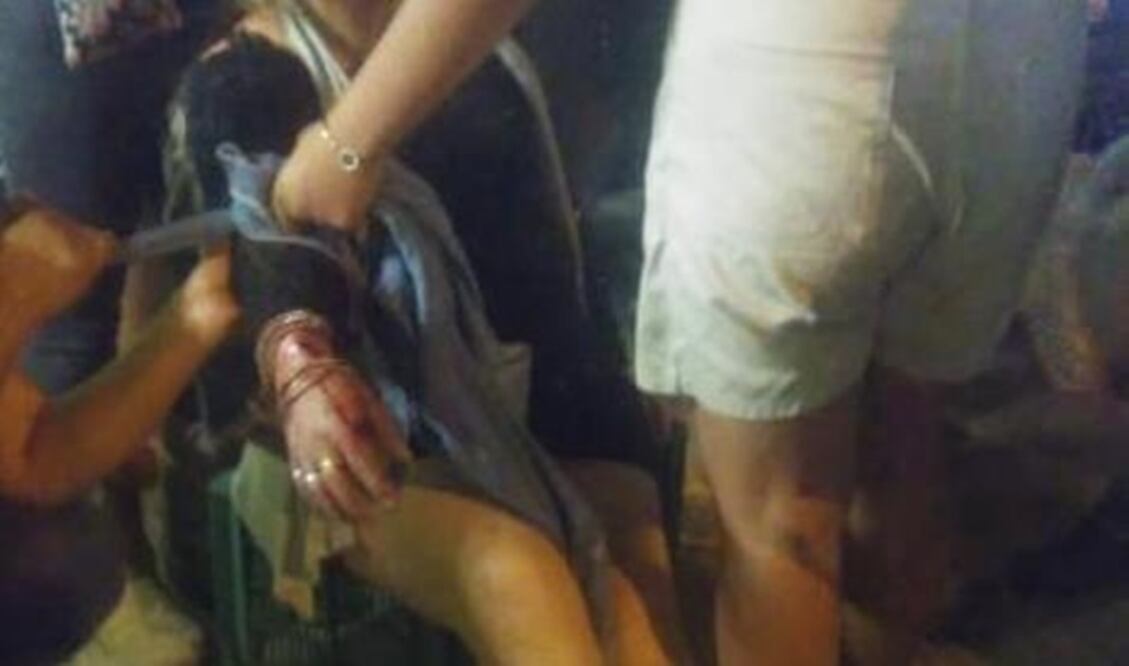 Una mujer que caminaba por la zona del enfrentamiento resultó lesionada. FOTO: Especial