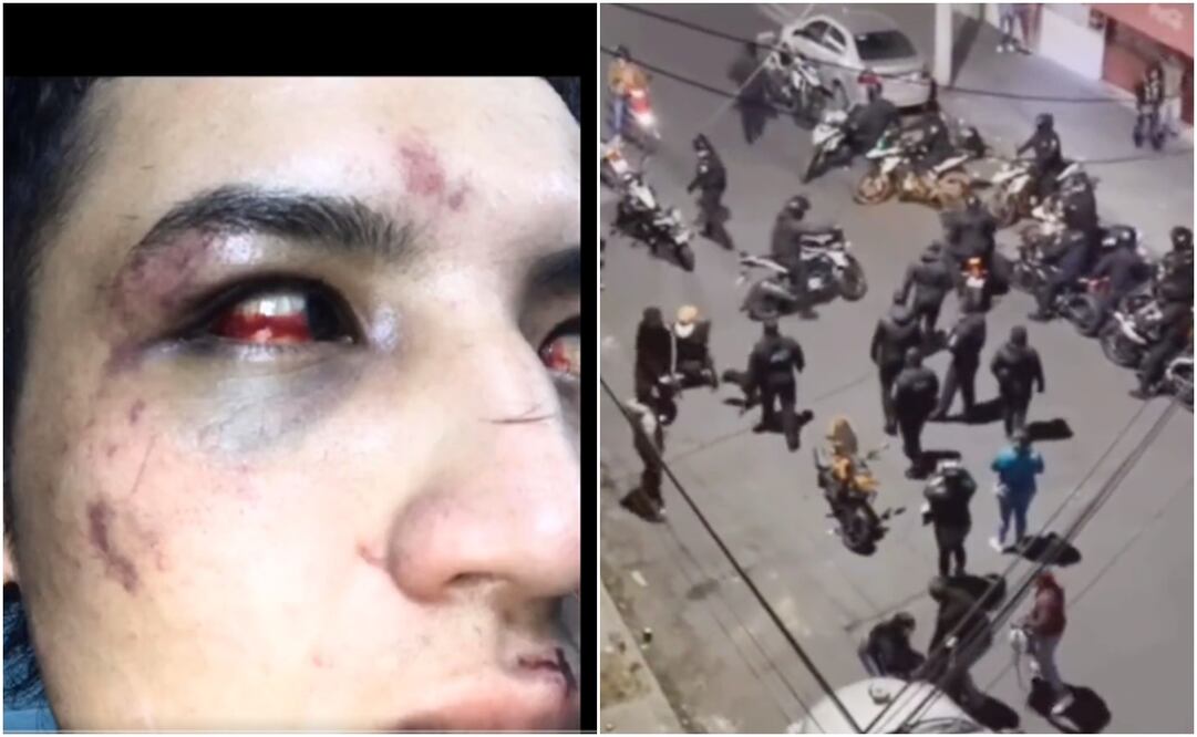 Policías agreden a pareja de la comunidad LGTB. Foto: Especial