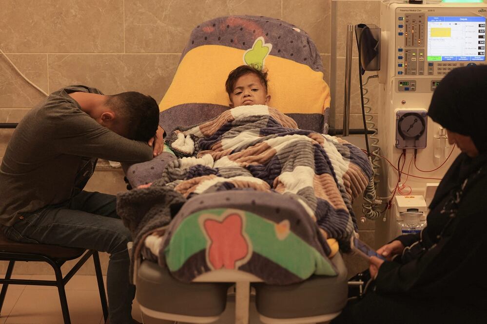 Un niño es sometido a diálisis en un hospital en  Khan Yunis, en el sur de la Franja de Gaza. FOTO: AFP