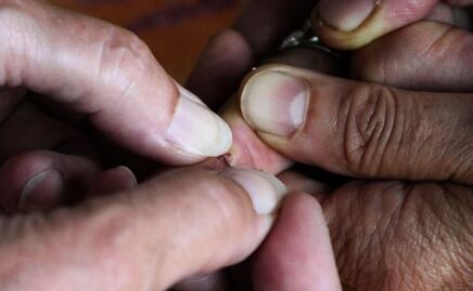 La planta "milagrosa" que cura las heridas de la piel en humanos y animales