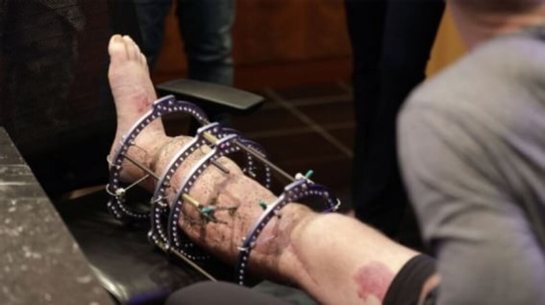 Alex Smith y su milagroso regreso a la NFL