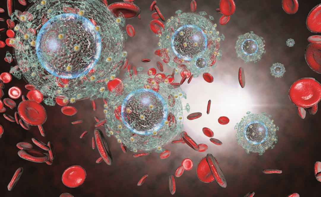 Imagen ilustrativa. Foto: Especial